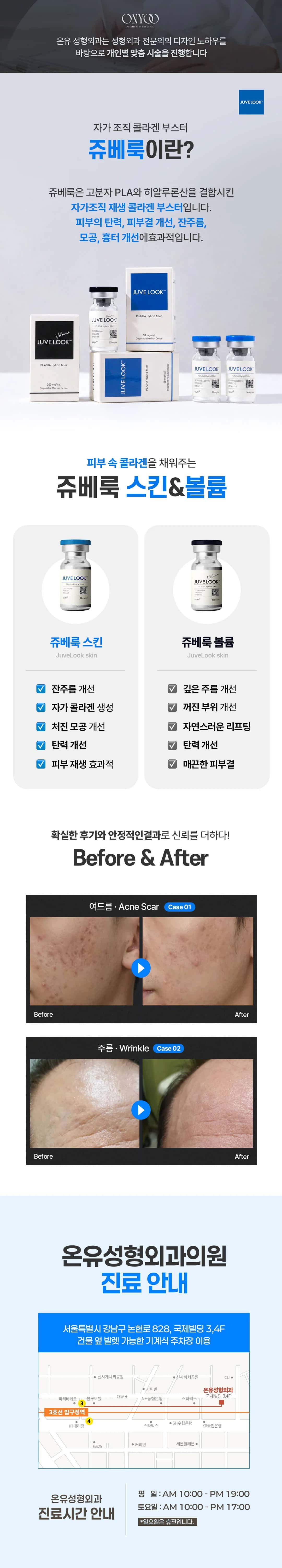 상세 이미지 1